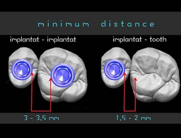 Quanto devono essere distanti gli impianti tra loro ?